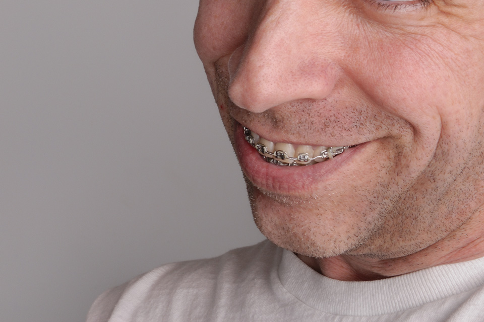 adult with braces smiling for the camera